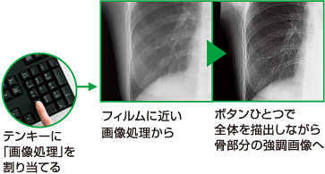 XP一般撮影