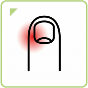 ひょう疽(化膿性爪囲炎)